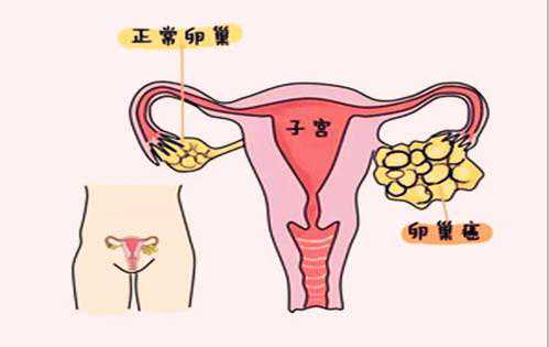 怀孕六周香港验血指标,不孕不育21步排查法，女性朋友不可忽视的11步！