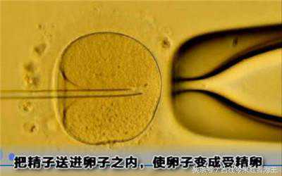 生化后一个月怀孕去香港验血会影响结果吗,记录试管婴儿全过程（附图）不孕