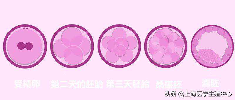 多囊怀孕香港验血,鲜胚移植第8天出血未必是试管失败的症状
