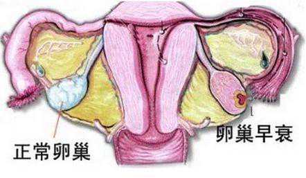怀孕了去香港验血要多少钱,卵巢早衰，26岁的女孩提前进入更年期，备孕4年未