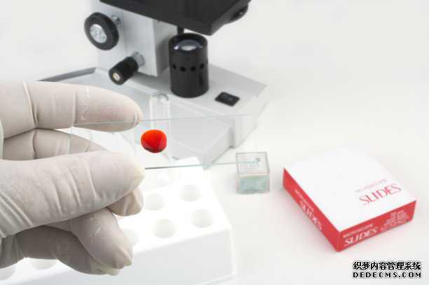 香港验血13周准确啊_香港验血测胎儿染色体查男女检测组织哪家正规？